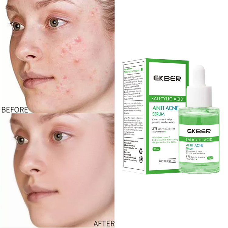 Sérum facial coreano de alta calidad con ácido salicílico, antiacné, reparador, reafirmante, nutritivo, iluminador, cuidado de la piel, tratamiento para el acné