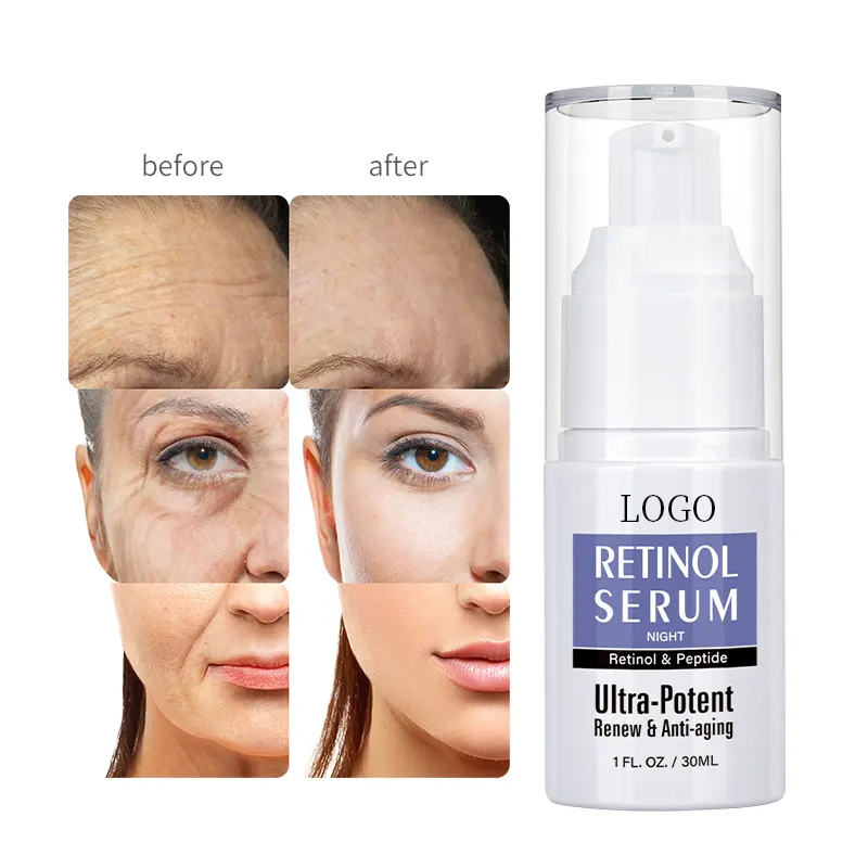 Suero facial de retinol anti-envejecimiento, arrugas, iluminador, ácido hialurónico + vitamina E de marca privada OEM