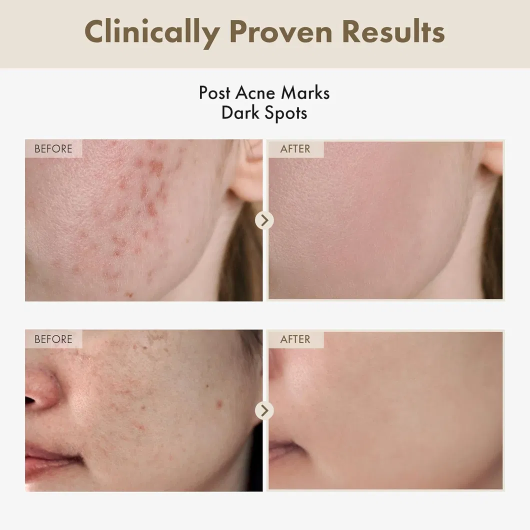 Presentación de suero facial