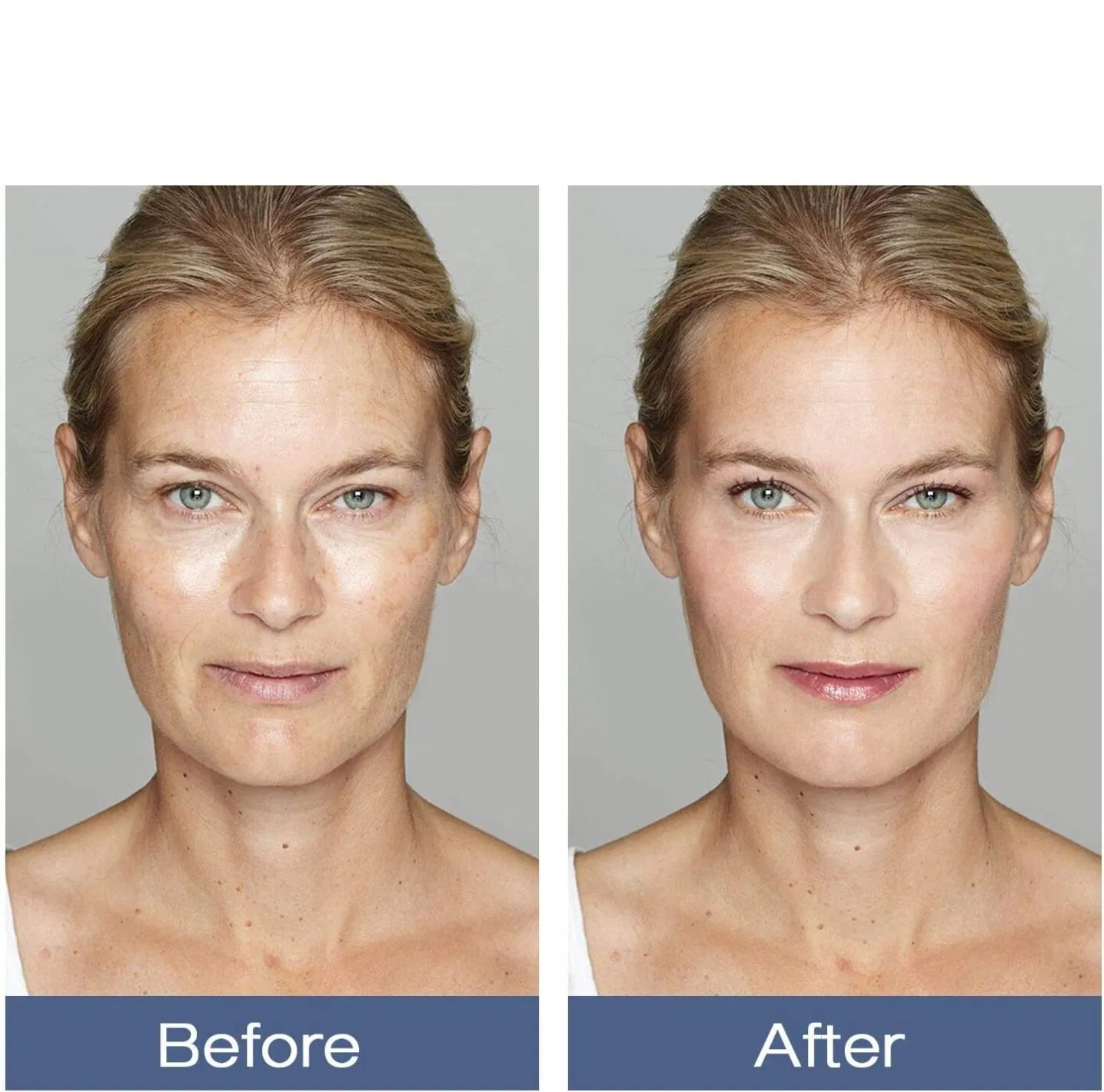 Suero facial natural orgánico antienvejecimiento de colágeno con ácido hialurónico