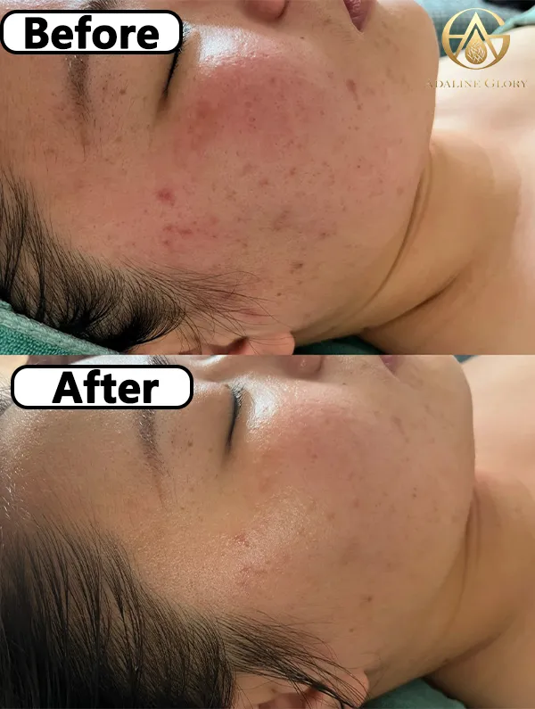 Before treatment status