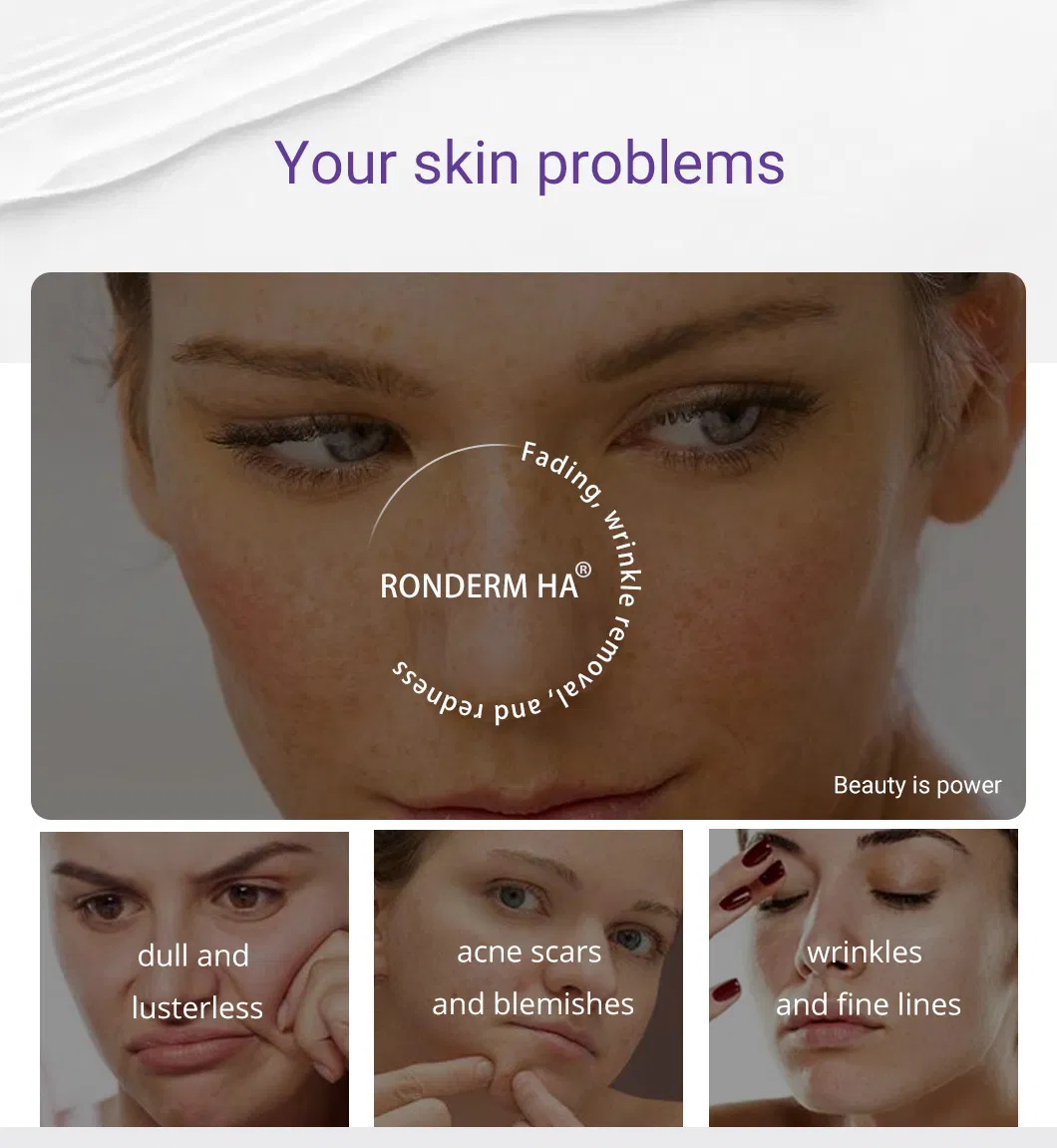 OEM Inyectable Acelerador de Piel Pdrn Mesoterapia para Rejuvenecimiento Facial 3ml*5