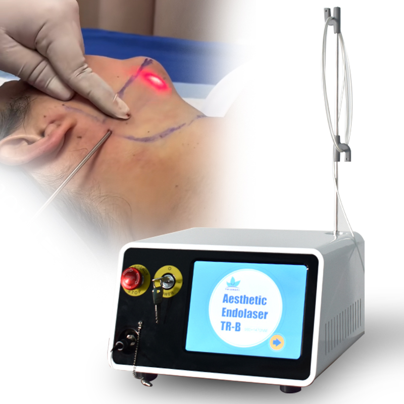 2 Longitudes de onda 980nm 1470nm Láser de diodo para la reducción de grasa corporal y lipólisis, lifting facial con endoláser