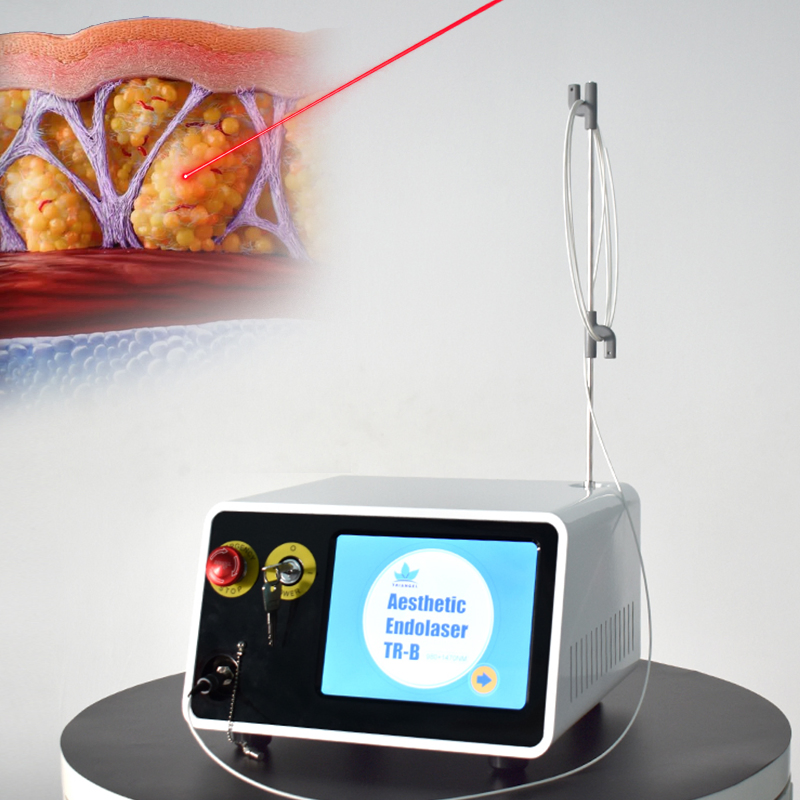 Liposucción Vaser Fiberlift 1470nm+980nm Máquina de Lifting Facial Endoláser Dispositivo Láser para Reafirmar la Piel