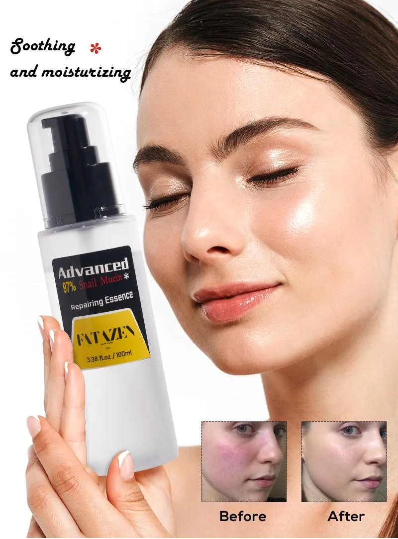 Suero reparador hidratante para la eliminación de manchas oscuras anti-edad al por mayor, productos de cuidado de la piel de etiqueta privada, suero facial antiacné de caracol