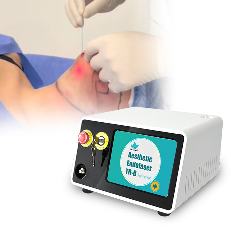 Cirugía Plástica Láser de Fibra para Lifting Facial 980nm 1470nm 47W Lipólisis Máquina de Elevación Endoláser