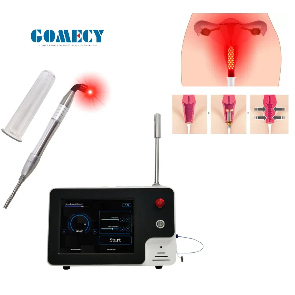 2025 Rejuvenecimiento Vaginal con Láser (LVR) 980nm 1470nm Cirugía de Rejuvenecimiento y Apretamiento Vaginal con Láser de Diodo, Mano de Láser
