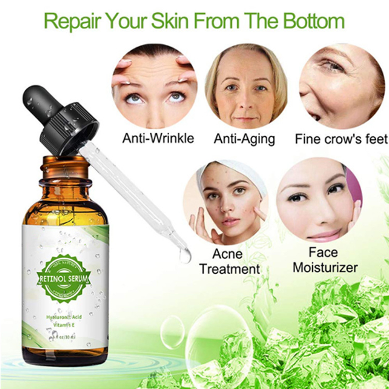 OEM Personalizado Mayorista Belleza Facial Anti Envejecimiento Tratamiento de Acné Suero de Ácido Hialurónico Vitamina E Retinol