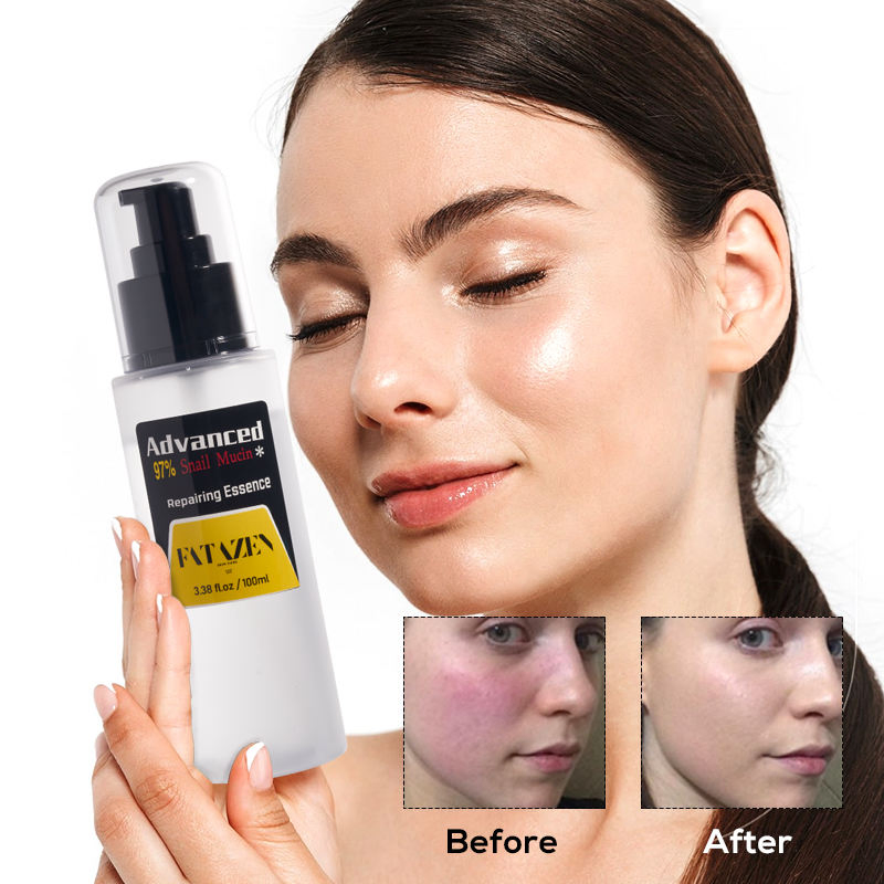 Suero hidratante reparador para la eliminación de manchas oscuras anti-edad al por mayor, productos de cuidado de la piel de etiqueta privada, suero facial de caracol antiacné