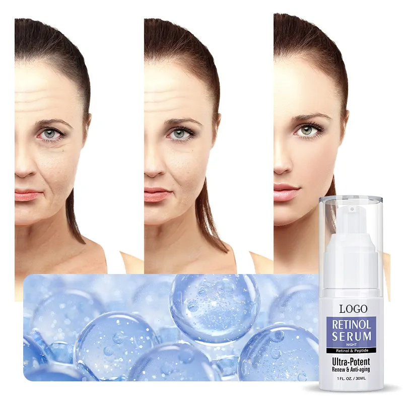 Suero facial de retinol anti-envejecimiento, arrugas, iluminador, ácido hialurónico + vitamina E de marca privada OEM