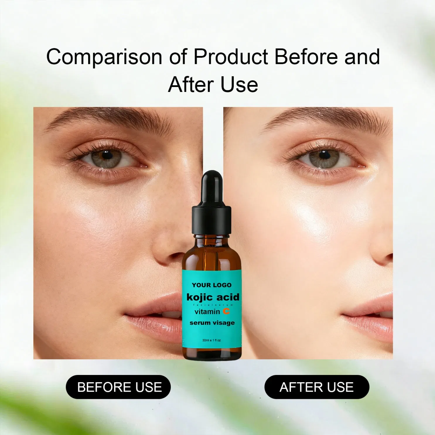 Esencia para el cuidado facial de ácido hialurónico y arbutina 30ml suero blanqueador de ácido kójico