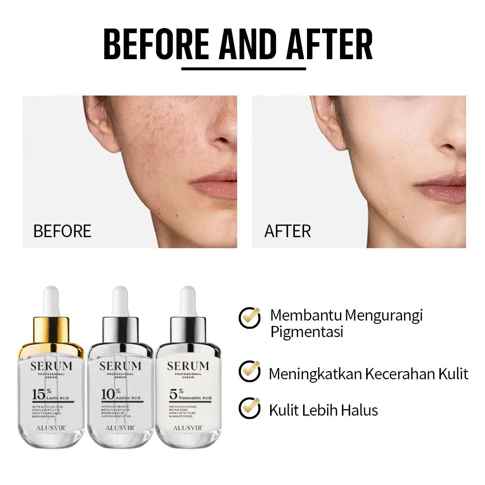 Suero facial orgánico iluminador antiacné con ácido azelaico