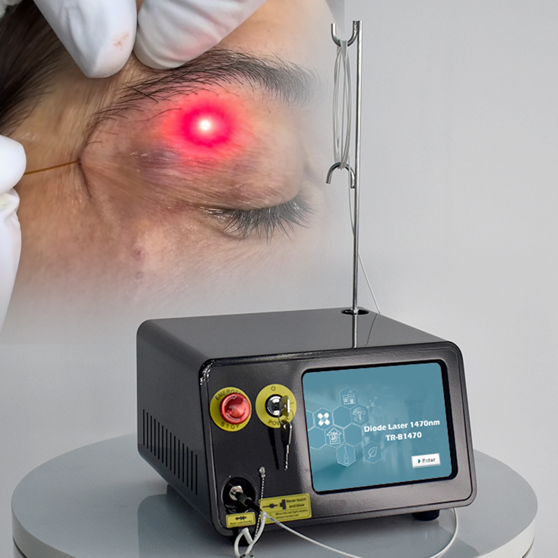 Venta Caliente de Triangel Factory 1470nm Máquina de Cirugía Plástica de Liposucción con Láser de Diodo Lipólisis Láser Doble Papada Endoláser Lifting Facial