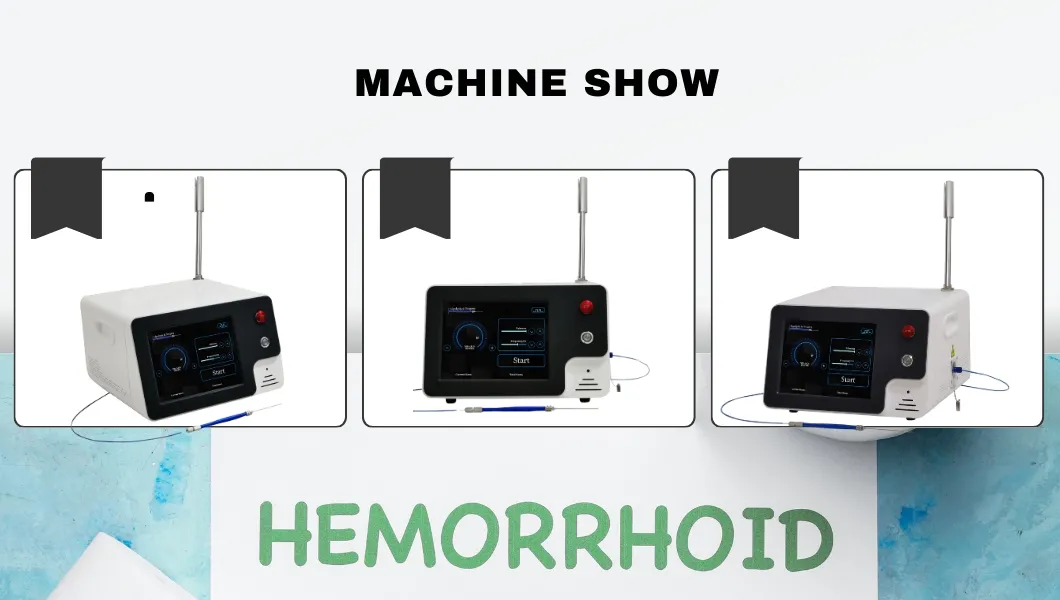 Equipo de láser Evlt/ Tratamiento Evlt Tratamiento de dolor en las venas de las piernas Clase 4 Láser en venta Variceslaser Endovascular PARA Varices Disolviendo grasas