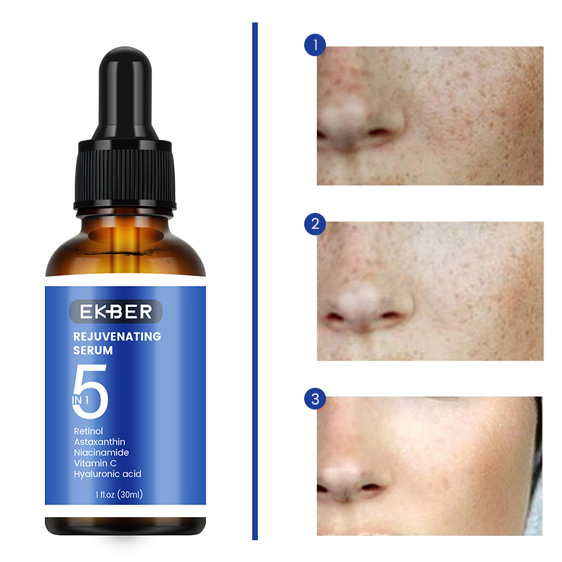 Suero para el cuidado de la piel de venta caliente Retinol Niacinamida Vitamina C Ácido Hialurónico Antienvejecimiento Alisante Reafirmante de la piel 5 en 1 Suero