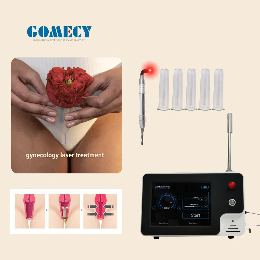 2025 Rejuvenecimiento Vaginal con Láser (LVR) 980nm 1470nm Cirugía de Rejuvenecimiento y Apretamiento Vaginal con Láser de Diodo, Mano de Láser
