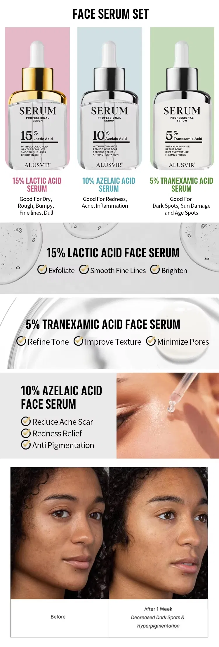 Suero facial orgánico iluminador antiacné con ácido azelaico