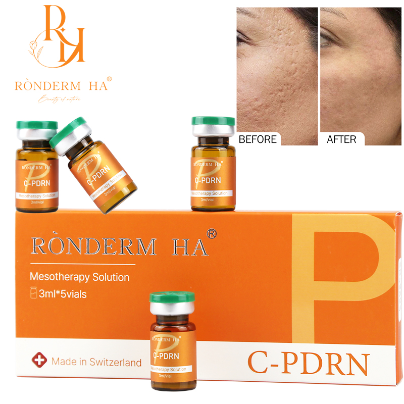 OEM Inyectable Acelerador de Piel Pdrn Mesoterapia para Rejuvenecimiento Facial 3ml*5