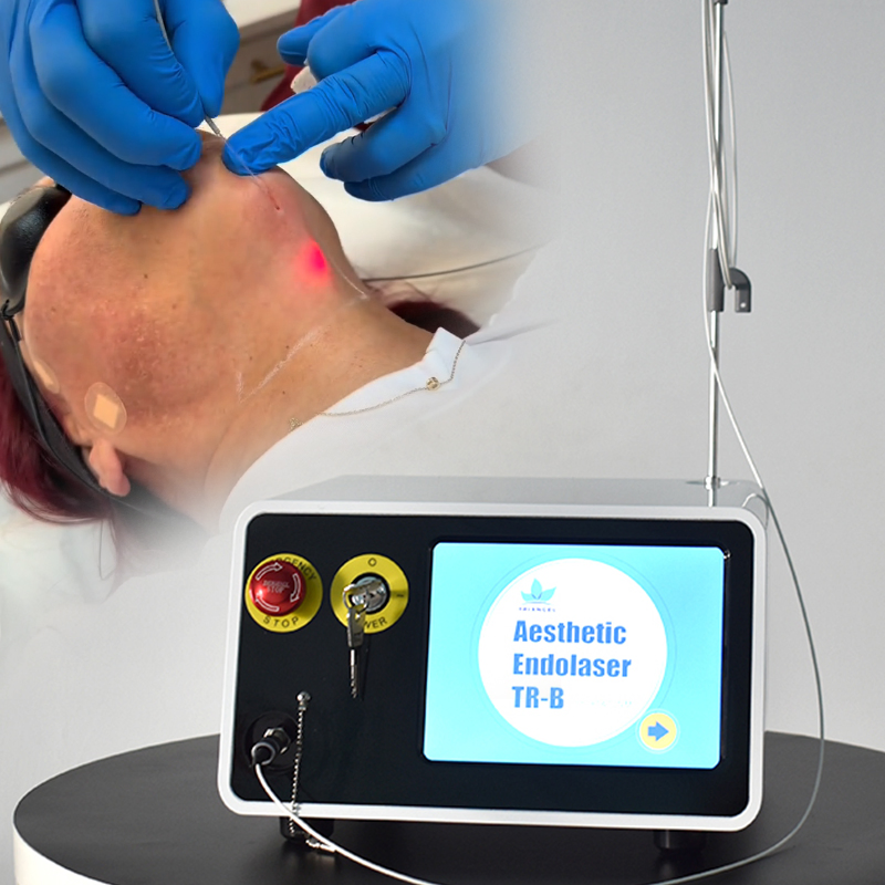 Liposucción Vaser Fiberlift 1470nm+980nm Máquina de Lifting Facial Endoláser Dispositivo Láser para Reafirmar la Piel