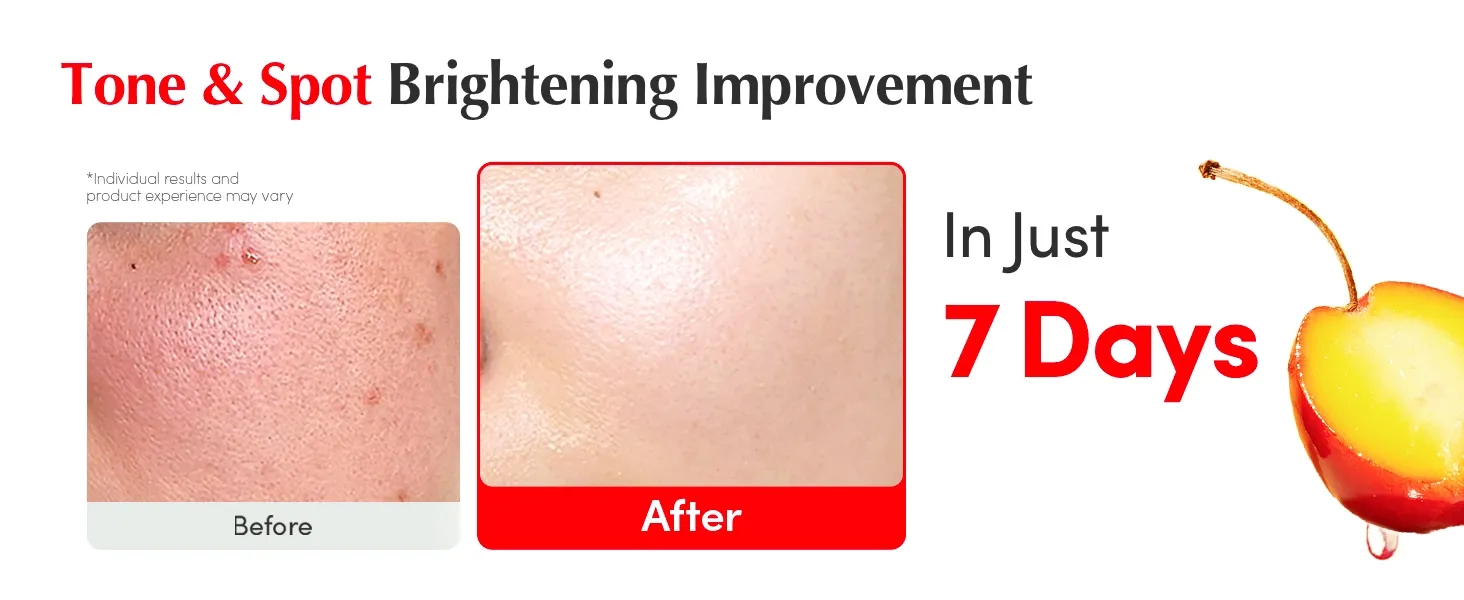Suero Facial