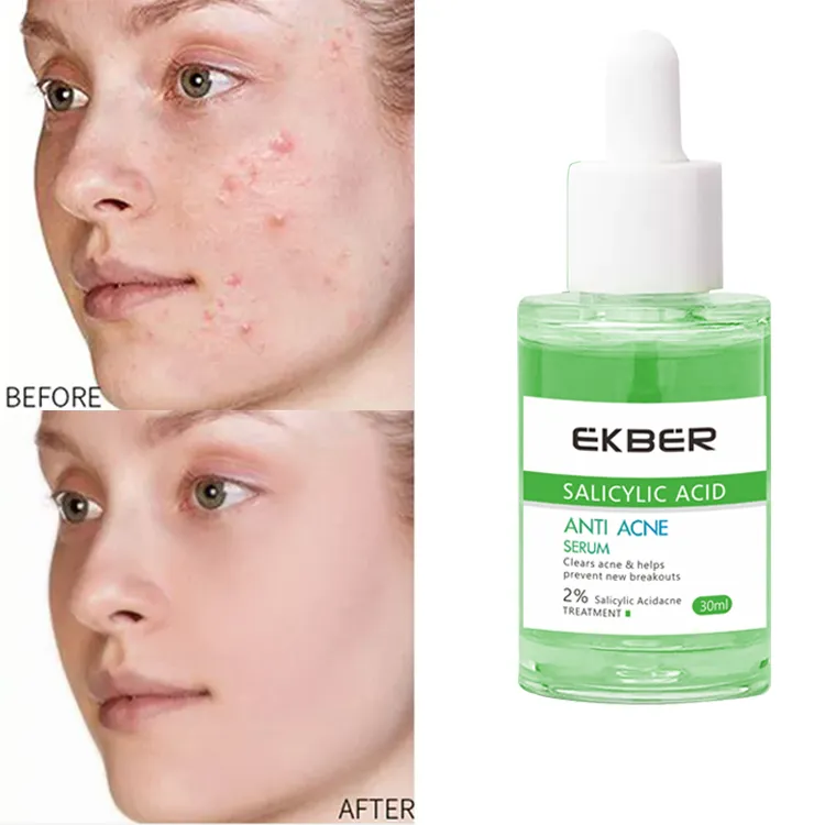 Sérum facial coreano de alta calidad con ácido salicílico, antiacné, reparador, reafirmante, nutritivo, iluminador, cuidado de la piel, tratamiento para el acné