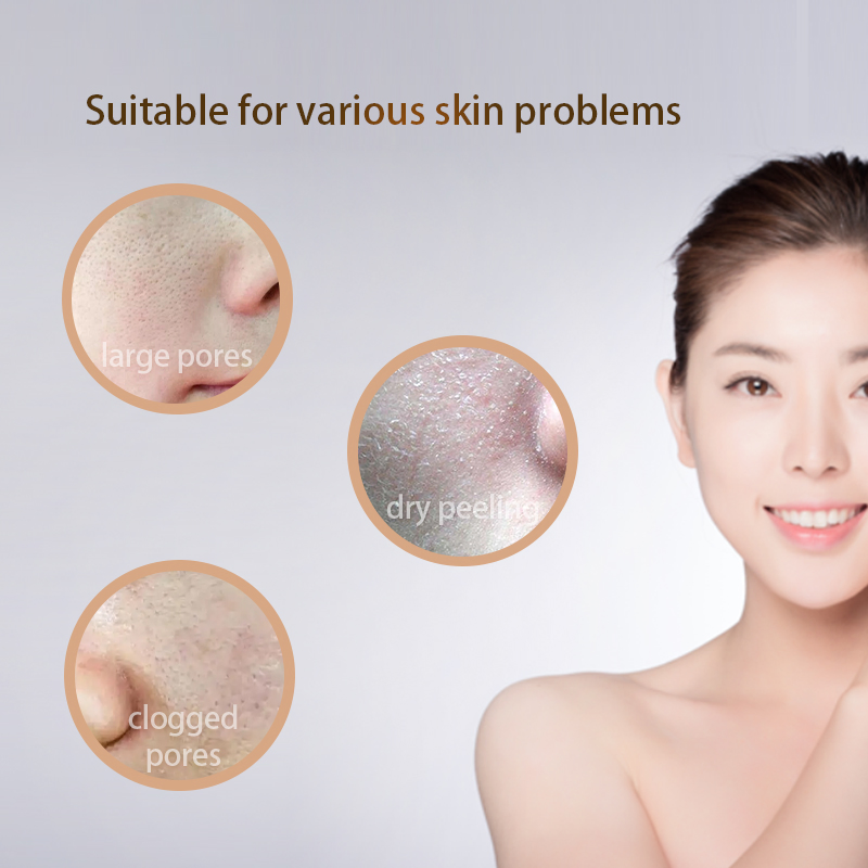Tratamiento para el acné con ácido hialurónico, exfoliante, contracción de poros, restaurar la elasticidad de la piel, suero facial