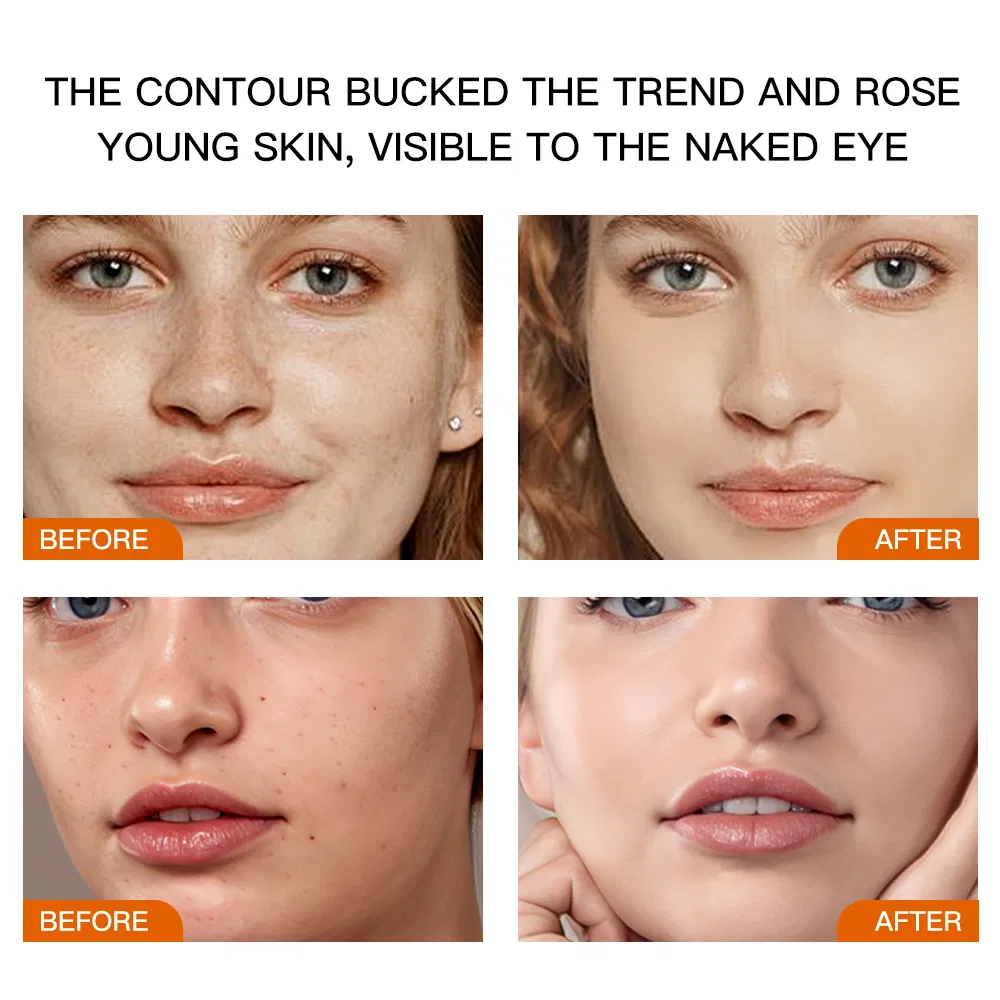 Suero blanqueador antiarrugas hidratante y humectante para el rostro, líquido de vitamina C, niacinamida, vegano, eliminación de líneas finas y pecas