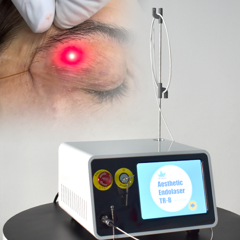 2 Longitudes de onda 980nm 1470nm Láser de diodo para la reducción de grasa corporal y lipólisis, lifting facial con endoláser