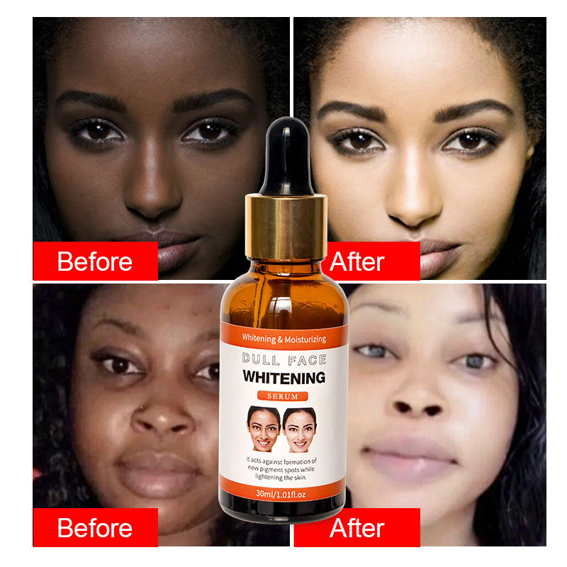 Suero Facial Natural de Arbutina de Marca Privada Orgánico Vegano Antienvejecimiento Aceite Esencial Esencias Visage Suero Blanqueador Facial