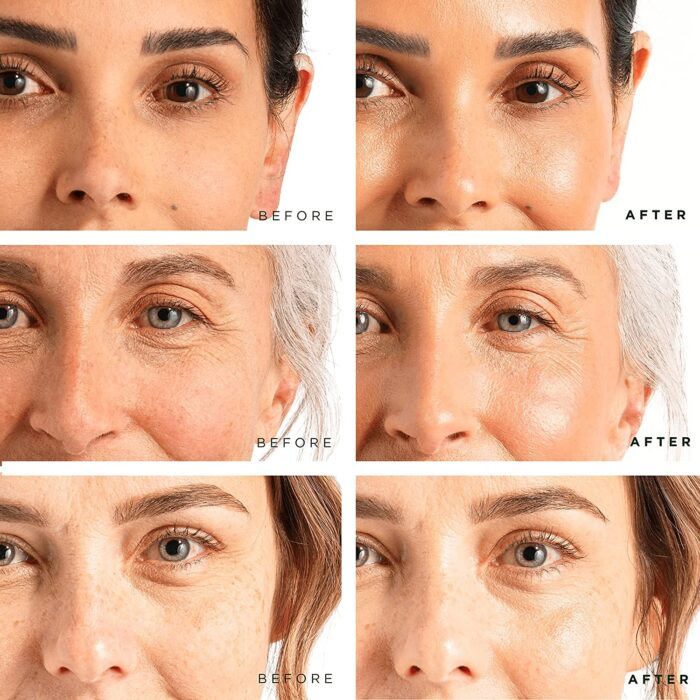 Suero facial de cuidado de la piel antienvejecimiento al por mayor con ácido hialurónico, niacinamida, vitamina C, E, retinol y cúrcuma