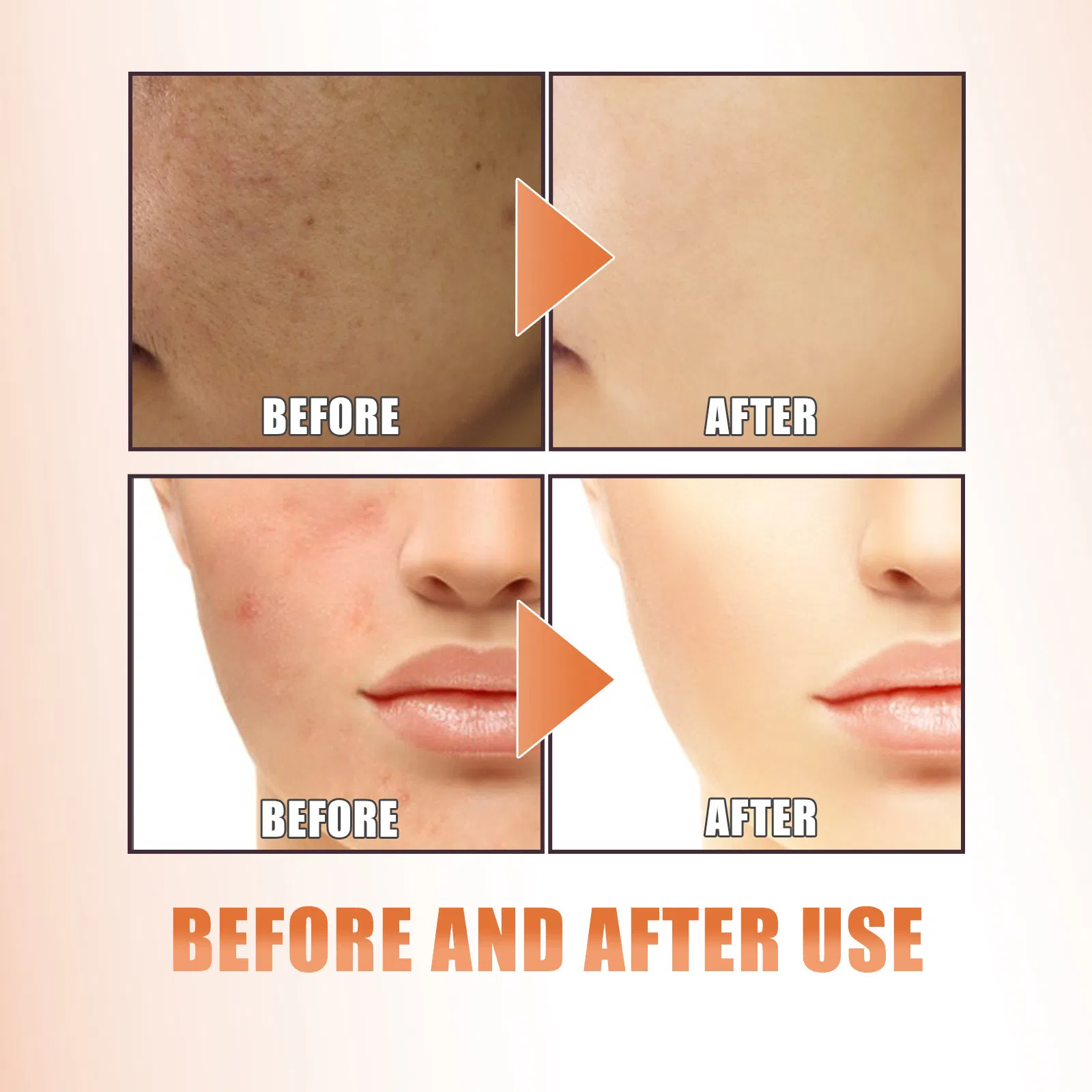 Suero facial iluminador y embellecedor, reafirmante, hidratante, humectante y reparador de la piel
