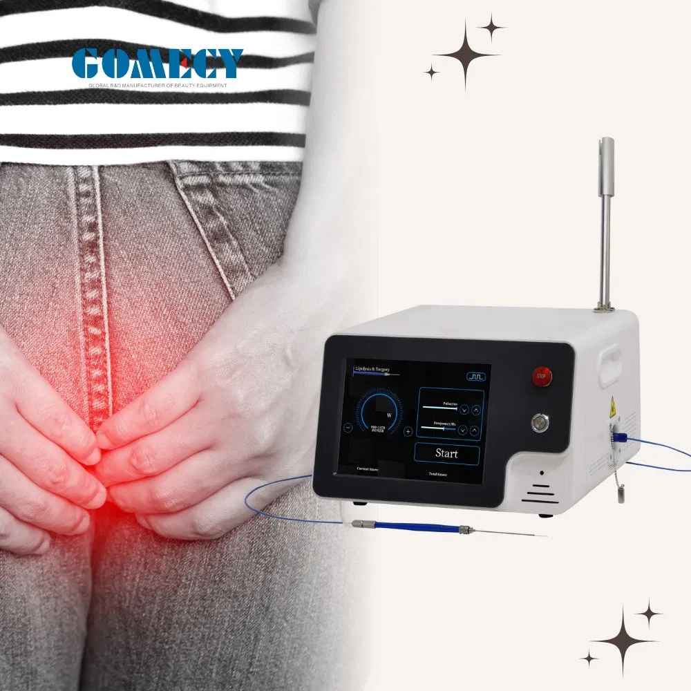 Equipo de láser Evlt/ Tratamiento Evlt Tratamiento de dolor en las venas de las piernas Clase 4 Láser en venta Variceslaser Endovascular PARA Varices Disolviendo grasas