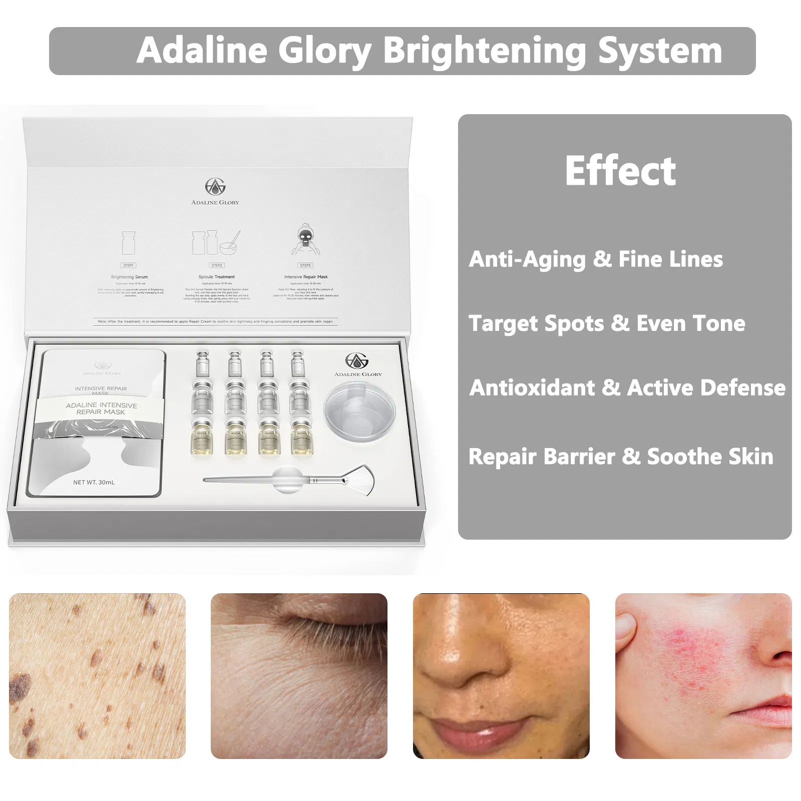 Precision Pigment Correction Bio-Microneedle Facial Kit Melasma Dark Spot Brightening Serum Repair Mask SPA Salon Wholesale OEM