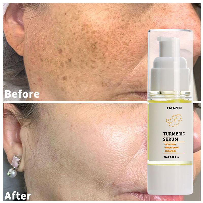 Suero facial iluminador de cúrcuma natural para el cuidado de la piel, suero facial blanqueador de vitamina C