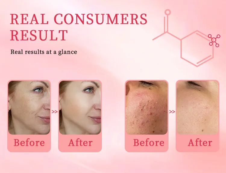 Suero facial hidratante blanqueador cuidado de la piel niacinamida pdrn bio péptidos fuente de salmón