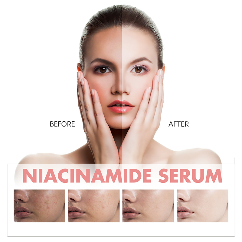 Sérum Facial Hidratante Antienvejecimiento Iluminador de Niacinamida de Durazno