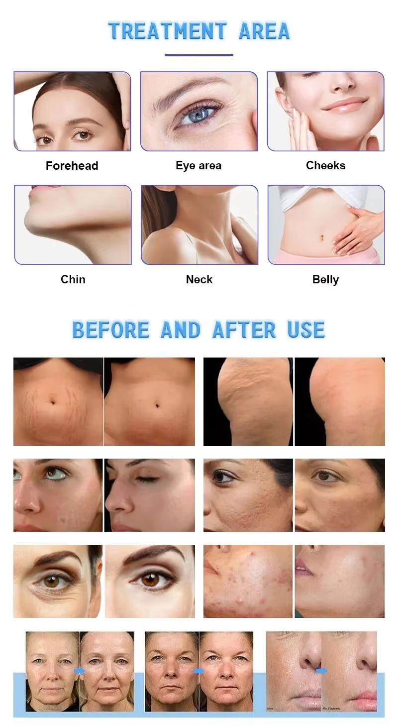 Clinical Results