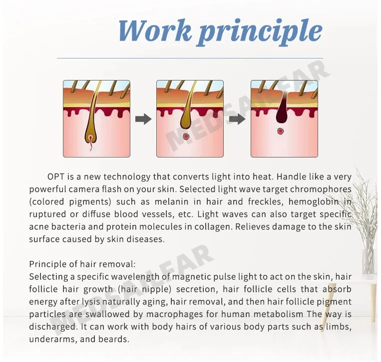 Working Principle 1