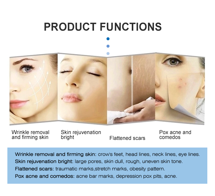 Portable RF Microneedling Machine for Skin Tightening and Stretch Mark Removal