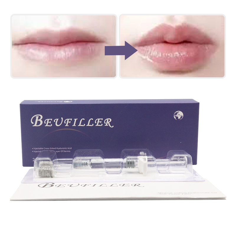 Ha Cosmetic Free Shipping CE for The Face Imjection Hydrogel Butt for Sale But Lifter Nose Hialuronic Acid Injection with Lidocane Dermal Fillers Online