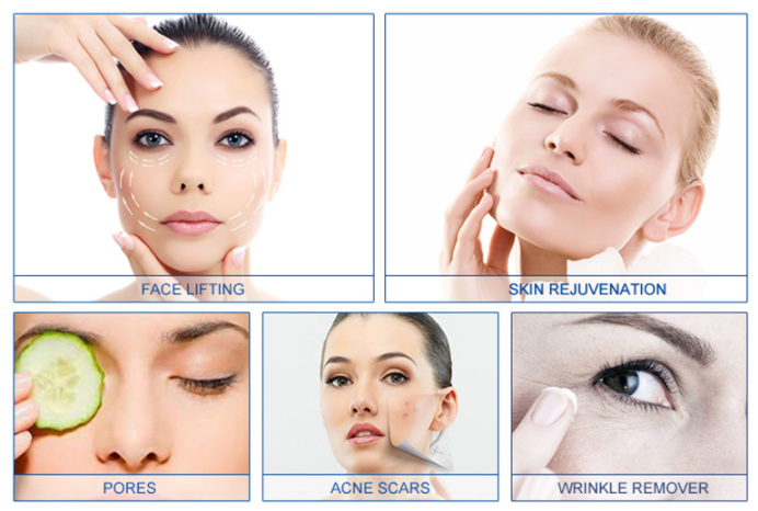 Most Popular RF Microneedle Machine for Face &amp; Body Skin Tightening with 2 Handles US Plug Compatible