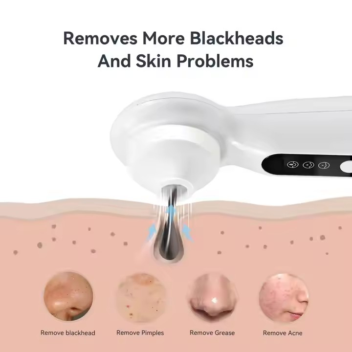 New LED Light Ultrasonic Skin Whitening Electric Vibrate Beauty Wand