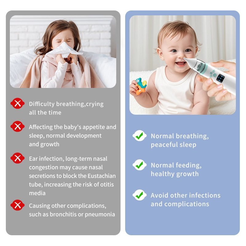 High-quality Hospital Vacuum Suck Automatic Booger Sucking High Suction Electric Nasal Aspirator