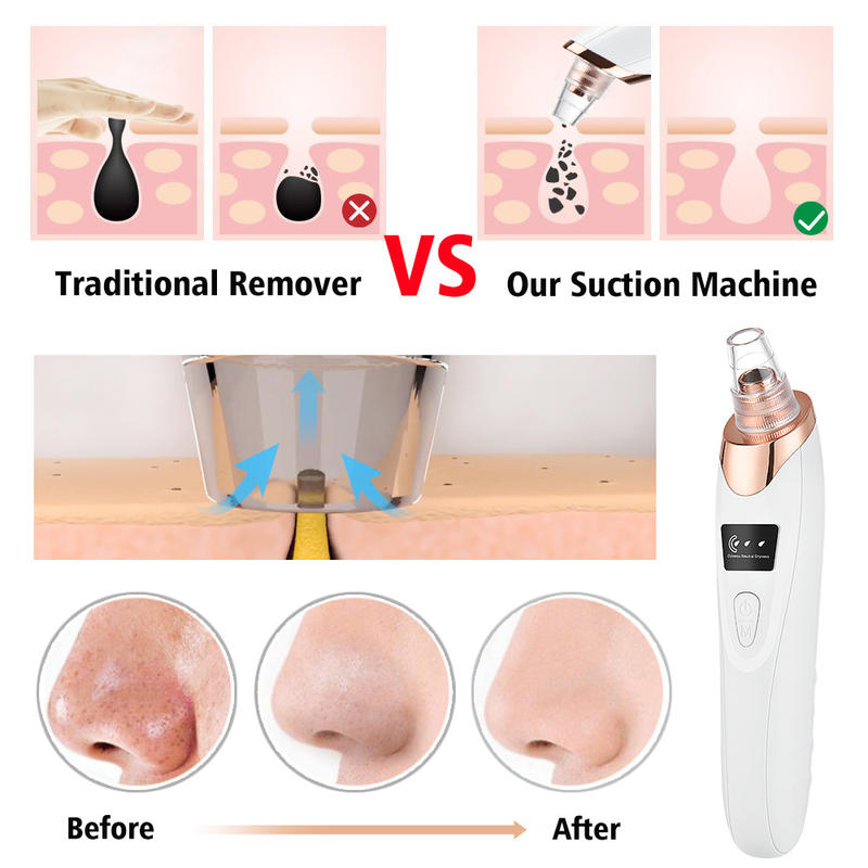 2026 Professional 5-in-1 Blackhead Remover Vacuum, Electric Pore Cleaner with 5 Heads for Facial Care