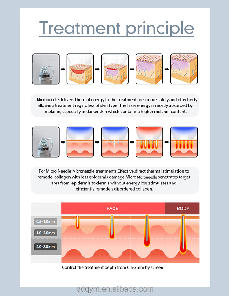 RF Device View 3