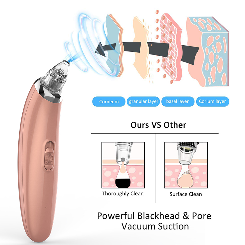 Blackhead Remover 3