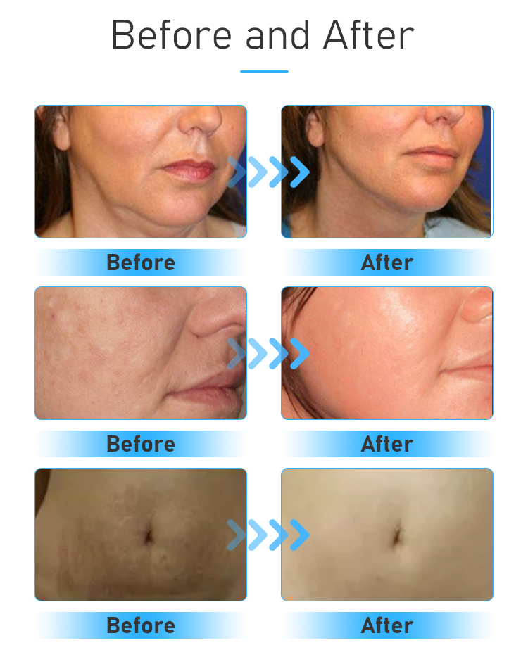 Clinical Results