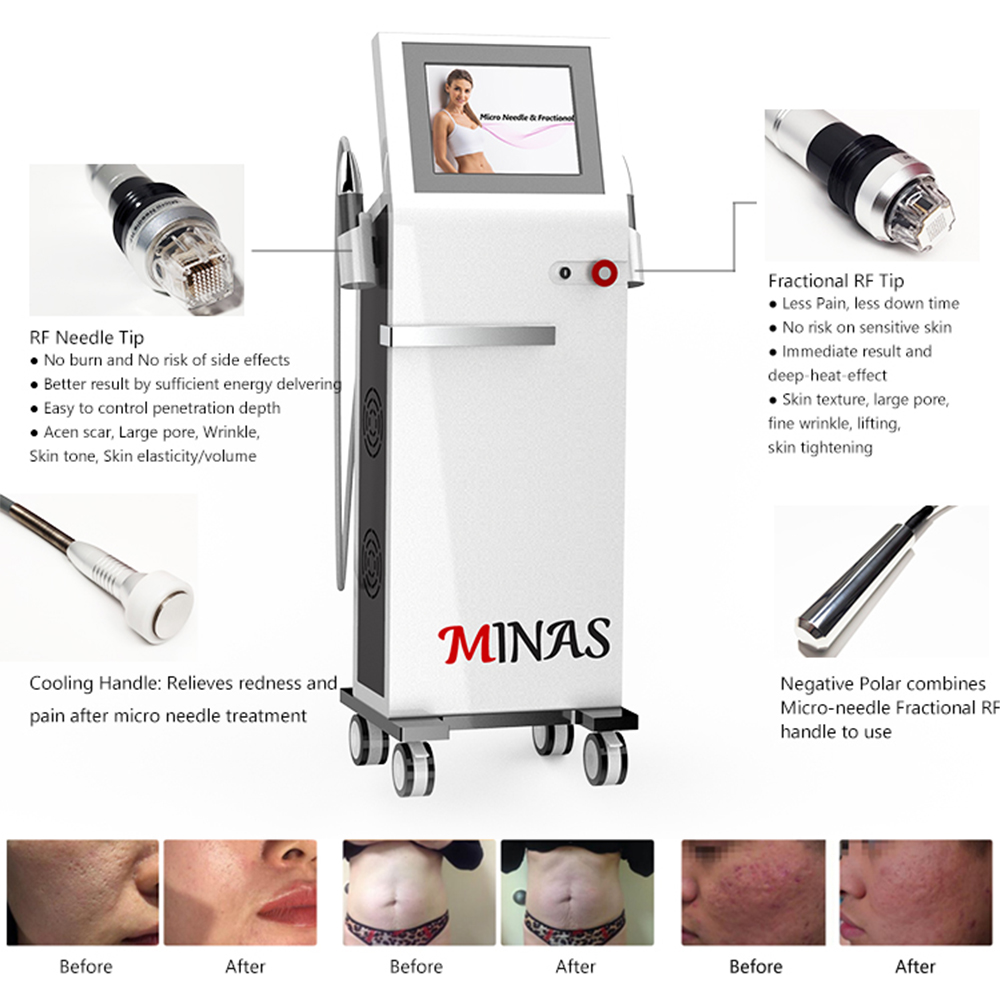 Aesthetic Medicine Radio Frequency Device Beauty Equipment Fractional RF Microneedle Face Lift Machine