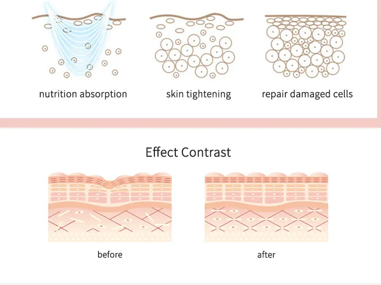Skin Care Face Lift Device Visual 3