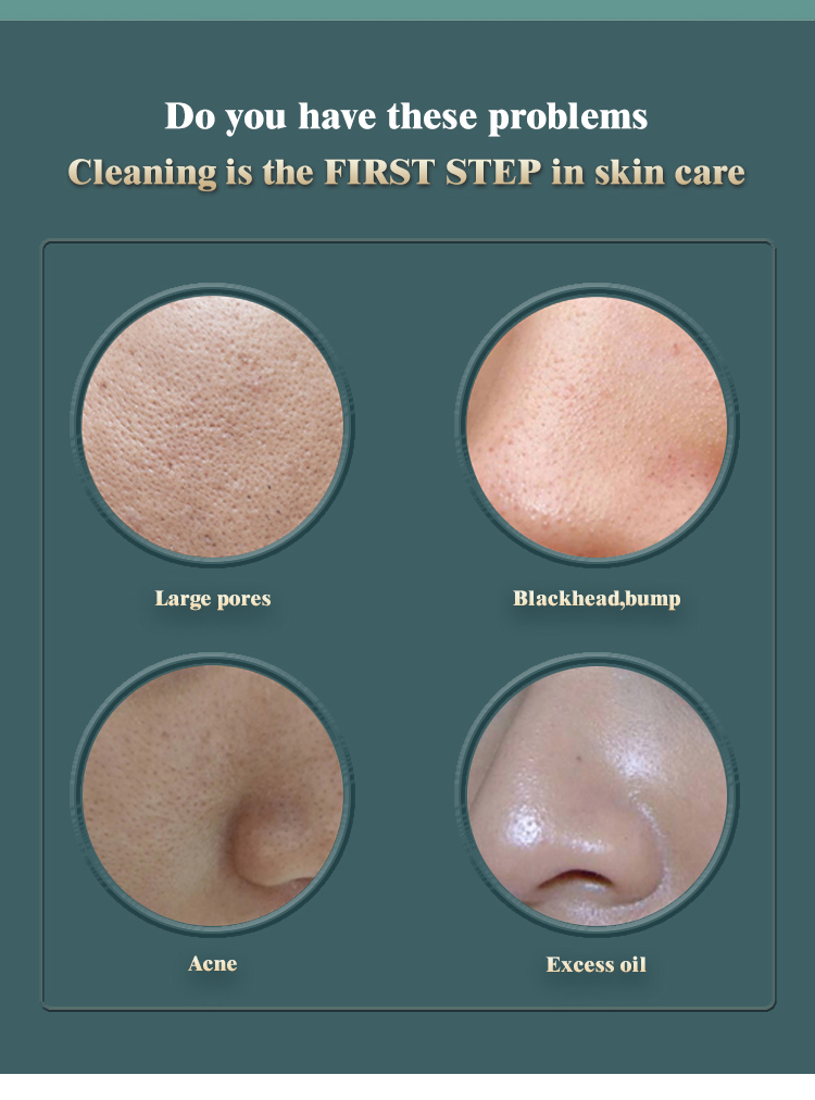 5 Head Pore Cleanser Vacuum Electric Suction Facial Comedo Acne Extractor Tool Kit Vacuum Blackhead Remover
